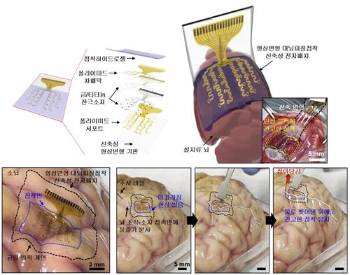 뇌파 측정해 뇌 질환 치료한다.환자 맞춤형 전자약 기술